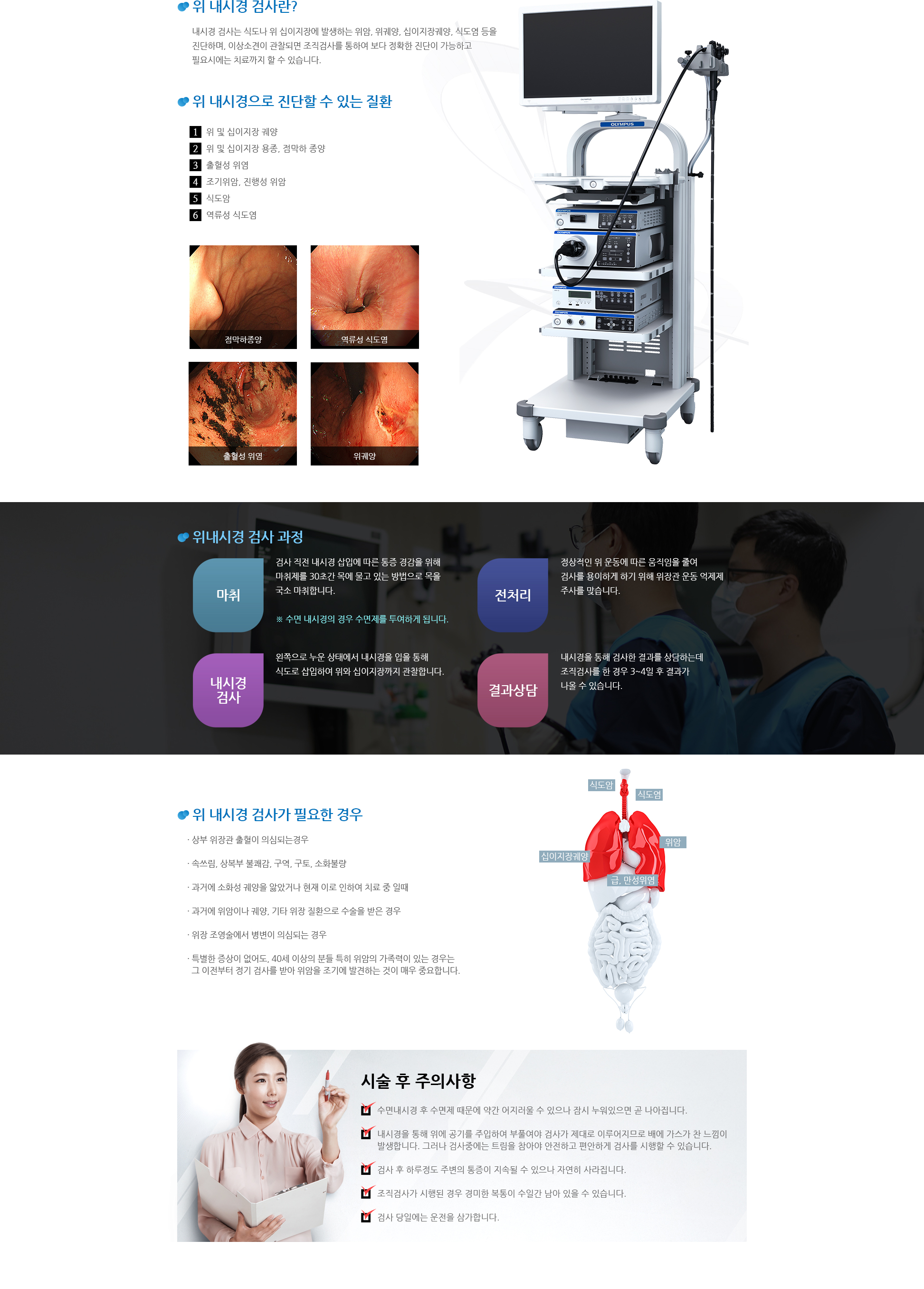 위내시경